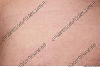 human skin hairy 0002